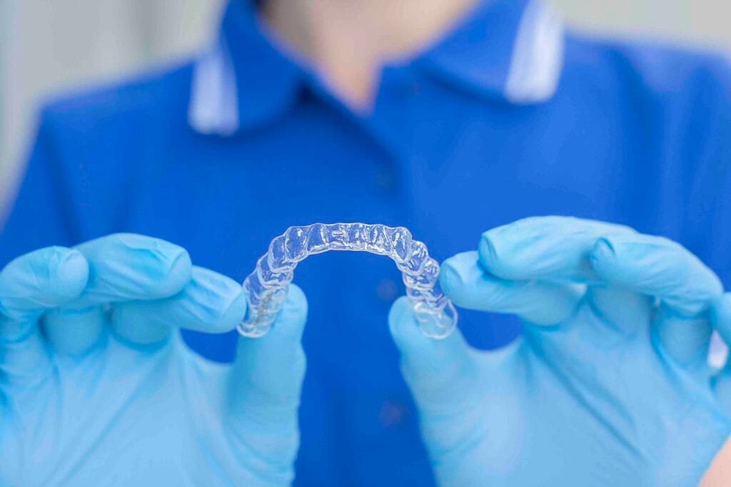 Come togliere gli aloni dall’apparecchio trasparente